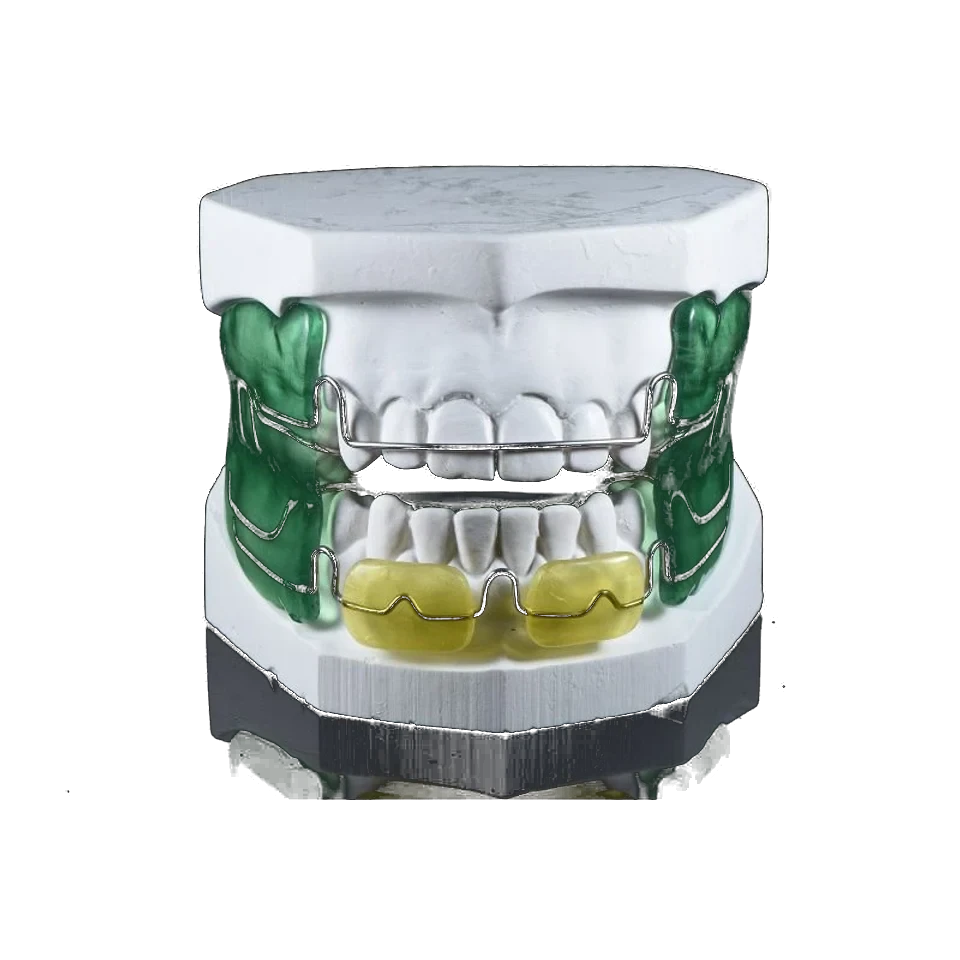 Removable functional orthodontic appliance with acrylic and wire components