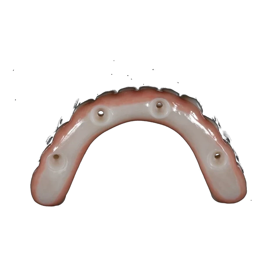 Full-arch zirconia implant bridge on a working model