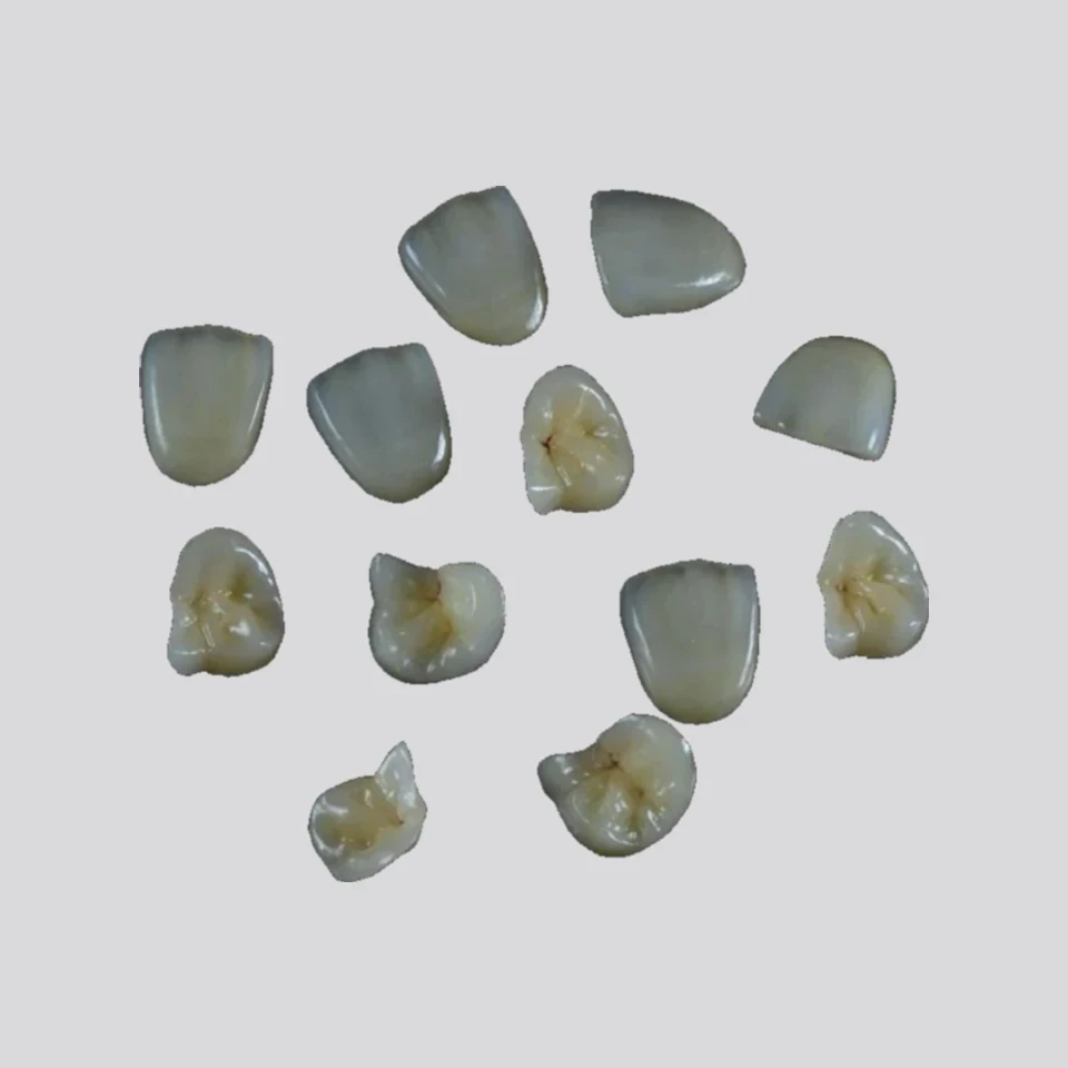 A set of indirect ceramic inlay and onlay restorations
