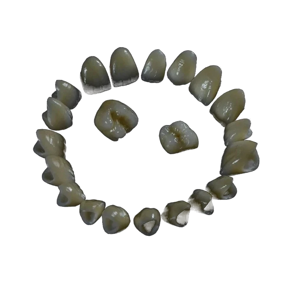 Layered zirconia crown with a veneered ceramic surface on a working model